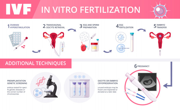 What are the steps involved in an IVF cycle?