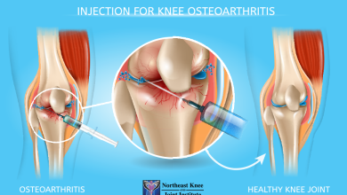 durolane knee injection